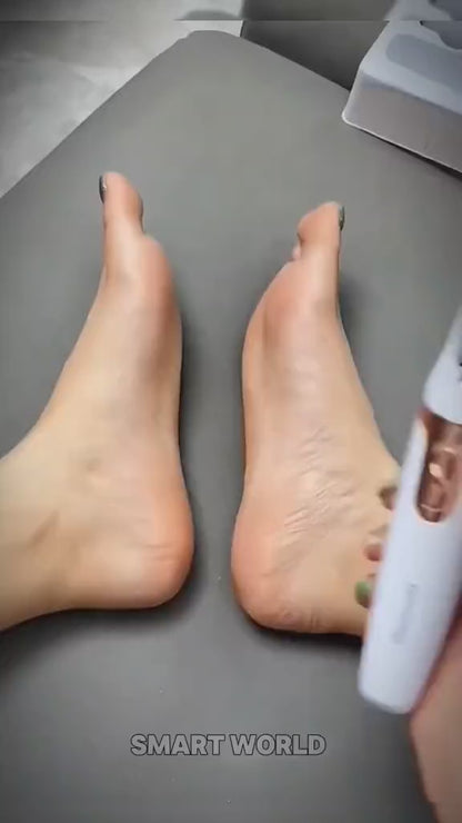 Electric Foot Callus Remover – Smooth Heels Pro